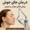 درمان جای جوش