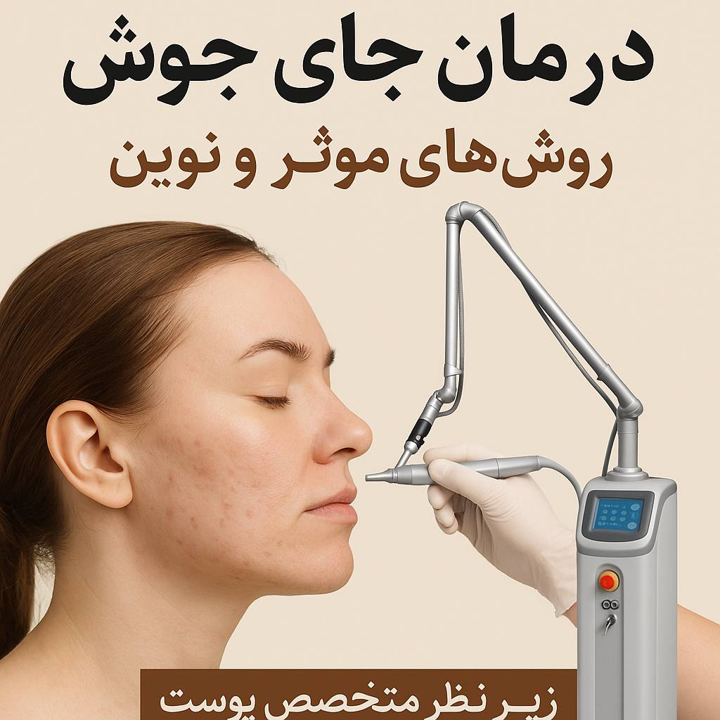 درمان جای جوش