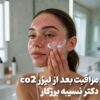 لیزر co2